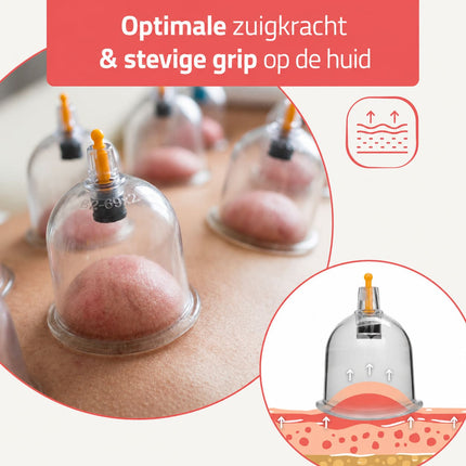 HABYS Cuppingset - 14 delig - met cuppingbekers - inclusief pomp